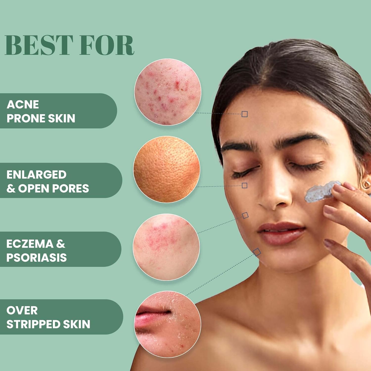 WildOak De Tan & Anti Acne Face Mask | With 7x Power of Niacinamide, Bamboo Charcoal, Ashwagandha, Calendula, Manjistha & Licorice | Hyperpigmentation & Wrinkles | Blackheads | Face Pack | 100gm