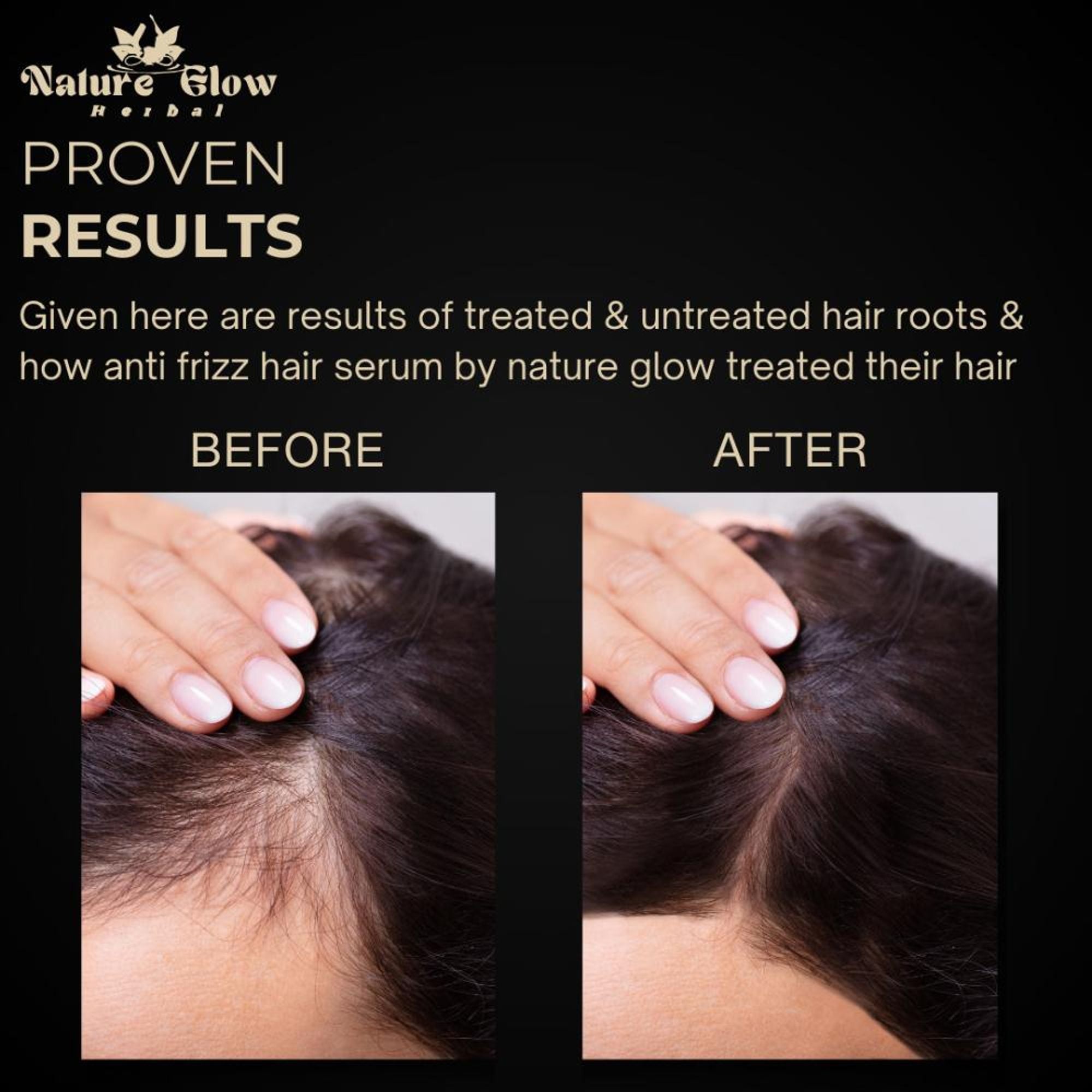 Nature Glow Herbal Anti Frizz Hair Serum