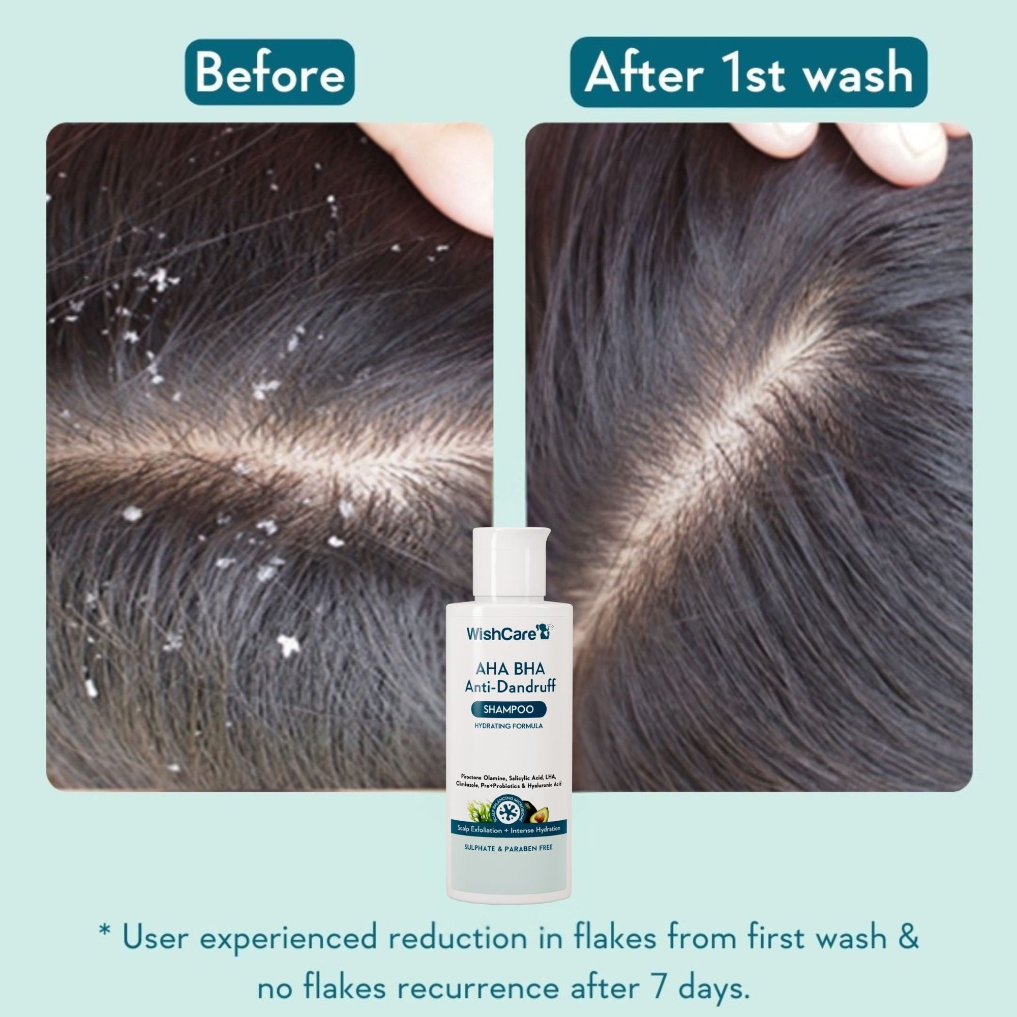 WishCare Hydrating AHA BHA Anti Dandruff Shampo-Reduces Flakes & Itchiness-100% Dandruff Reduction