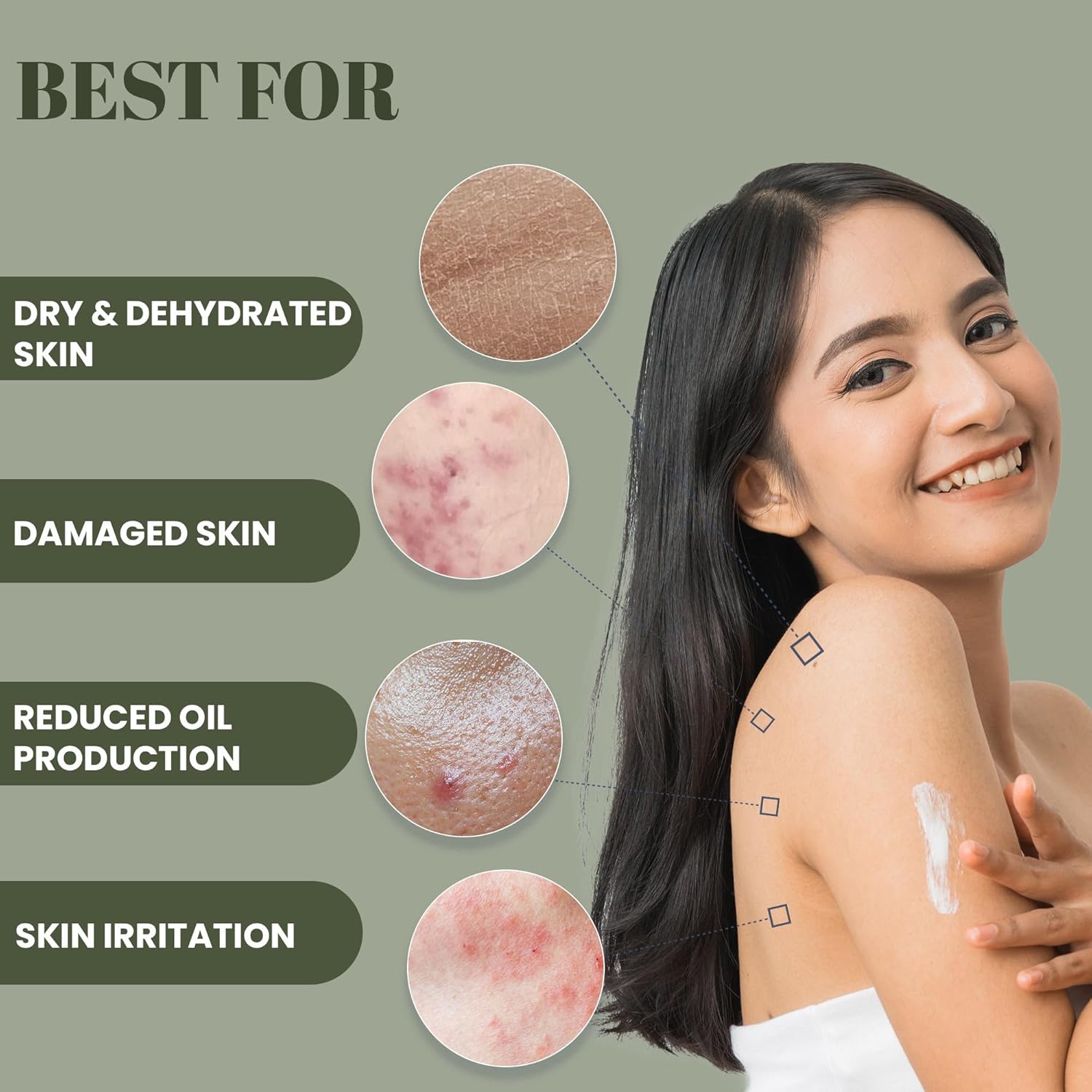 WildOak Super Hydrating Body Lotion | With 4x Power of Niacinamide, Shea Butter, Jojoba Oil & Australian Tea Tree | Soothes Skin Irritation & Itching | Non Sticky | For All Skin Types | 100ml Bottle