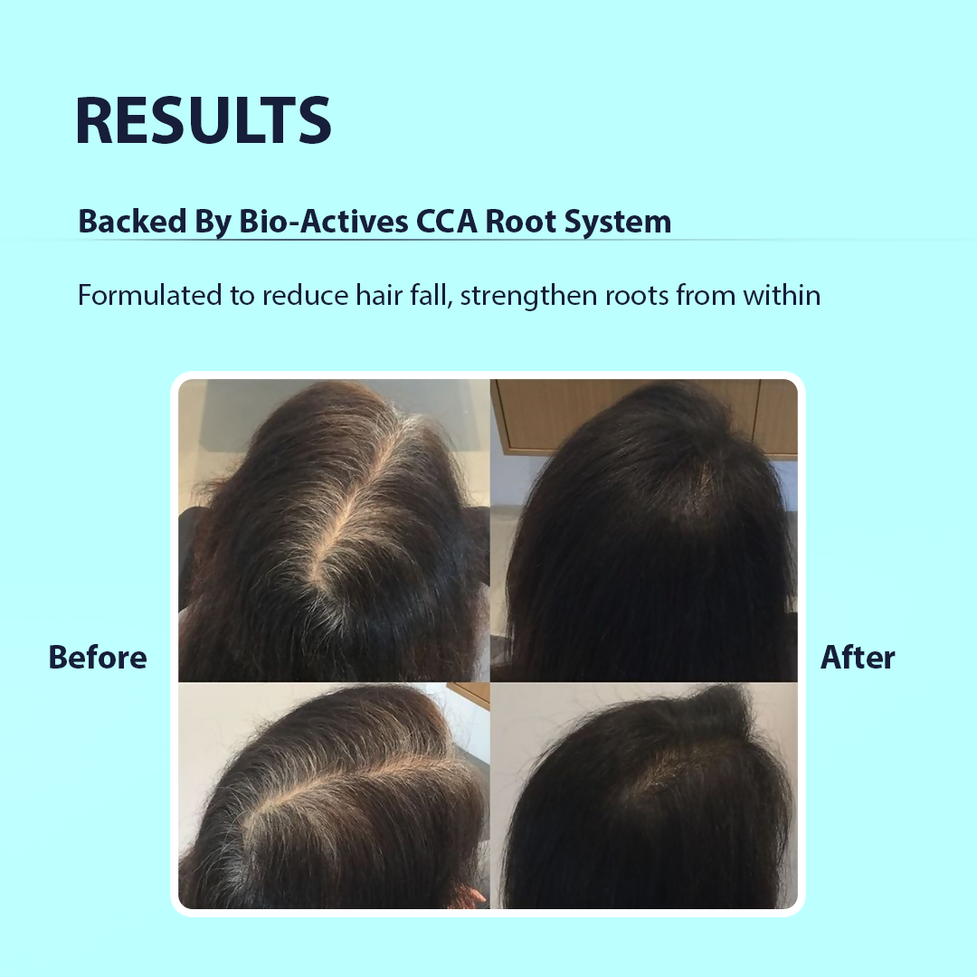 Dermistry Follicusan Hairgenyl & Caffeine Anti Hair Fall Control Serum Mask & Shampoo