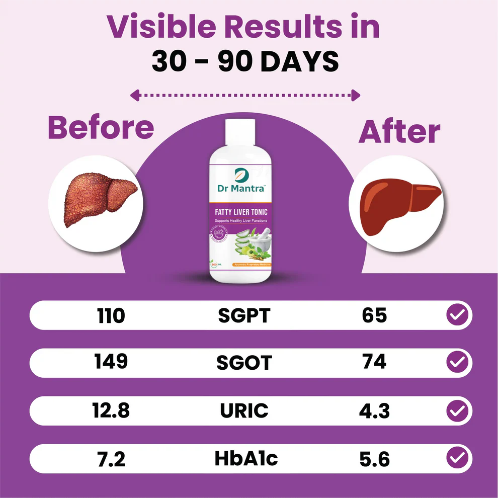 Dr Mantra Ayurvedic Fatty Liver Tonic for Healthy Liver| 300ml