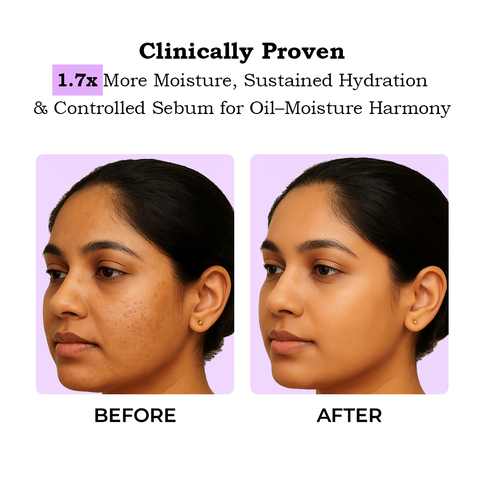 TYC Ceramide Moisturizer