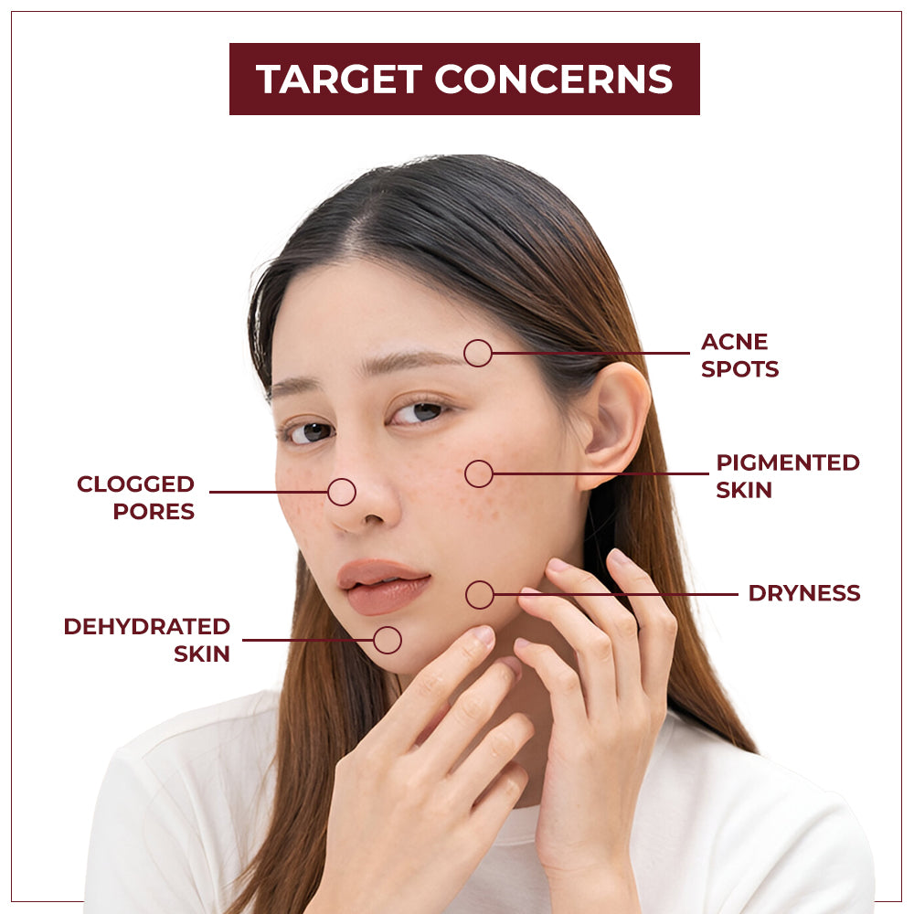 TYC Depigmentation Gel with 4% AHA For Men and Women