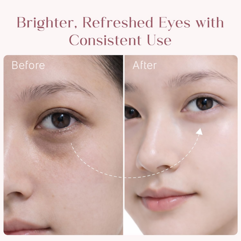 Seoulskin Under Eye Cream