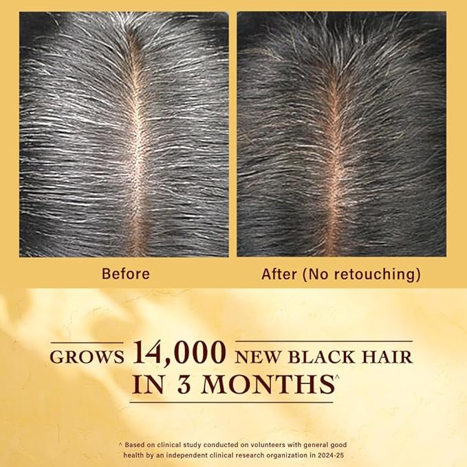 Indulekha Jatamansi Premature Greying Treatment Scalp Serum