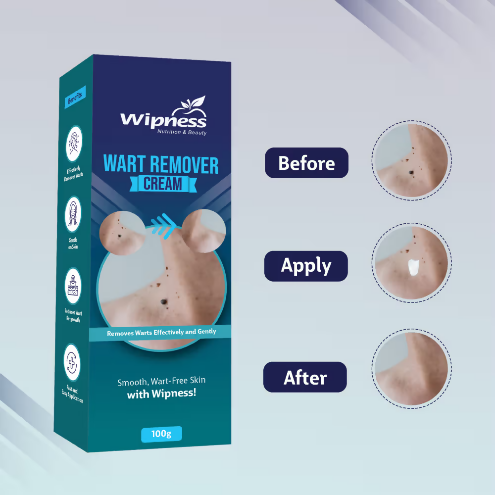 Wipness Natural Wart Remover Cream For Men & Women