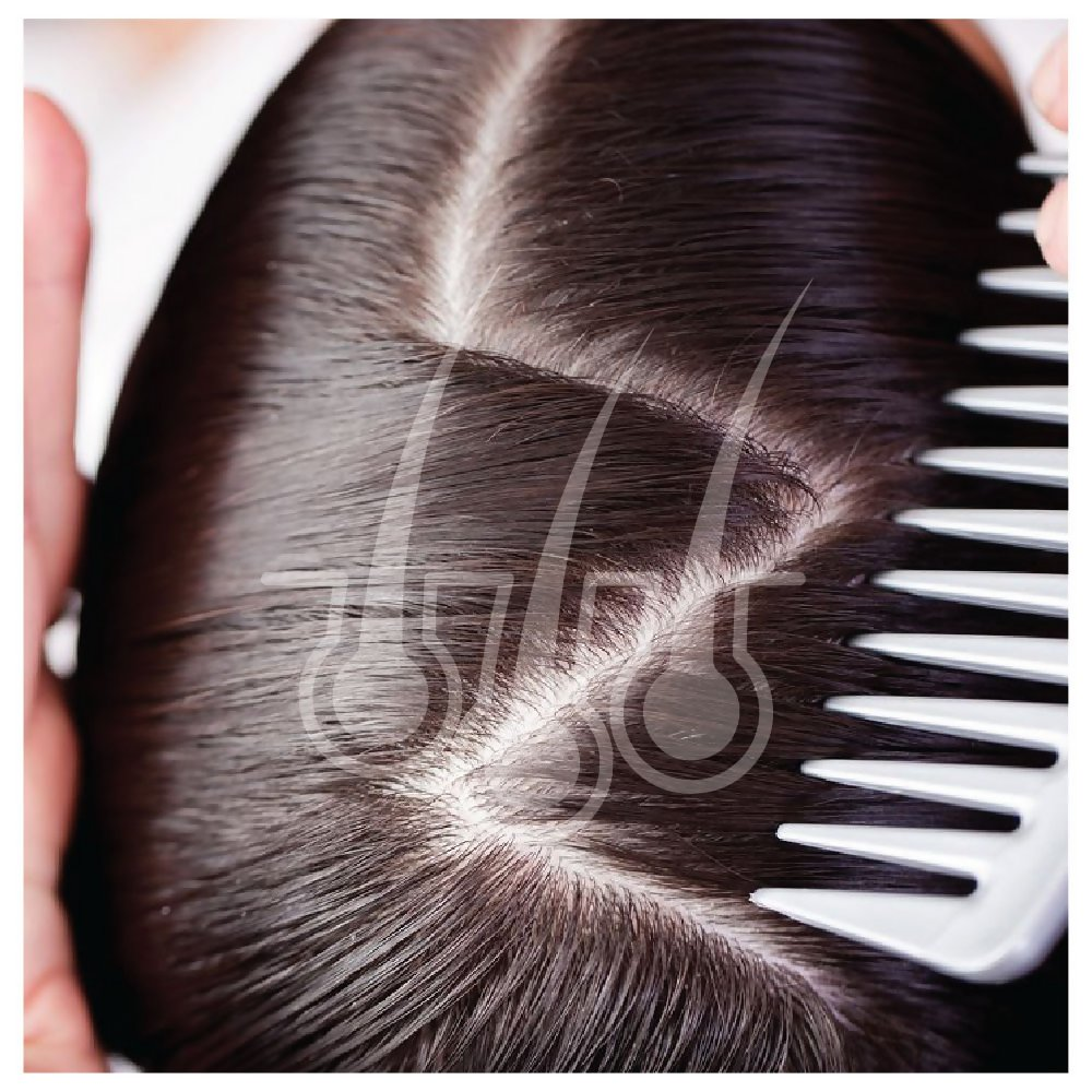 Vegetal Hair Well For Hair Fall Control