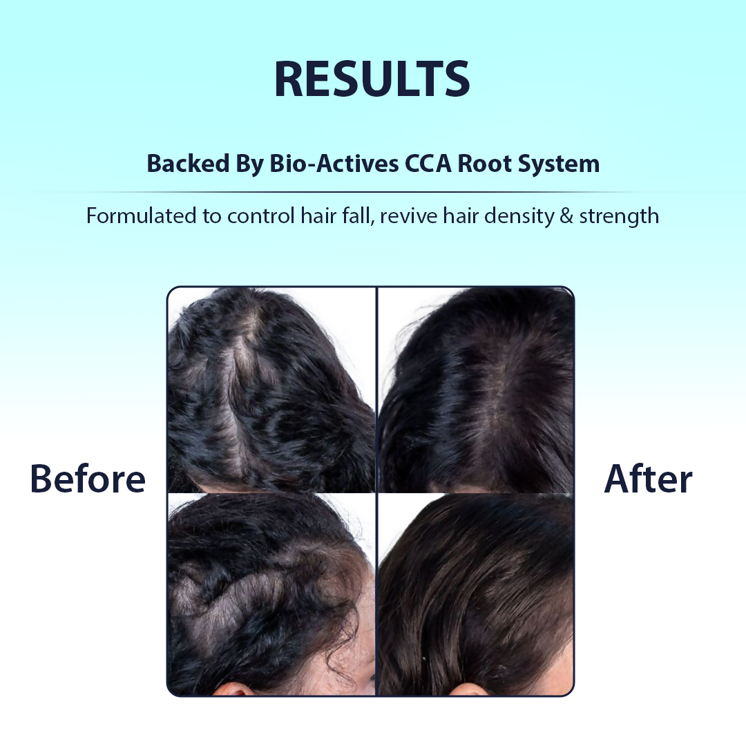 Dermistry Caffeine Collagen Protein Anti-Hair Fall Control Mask & Serum
