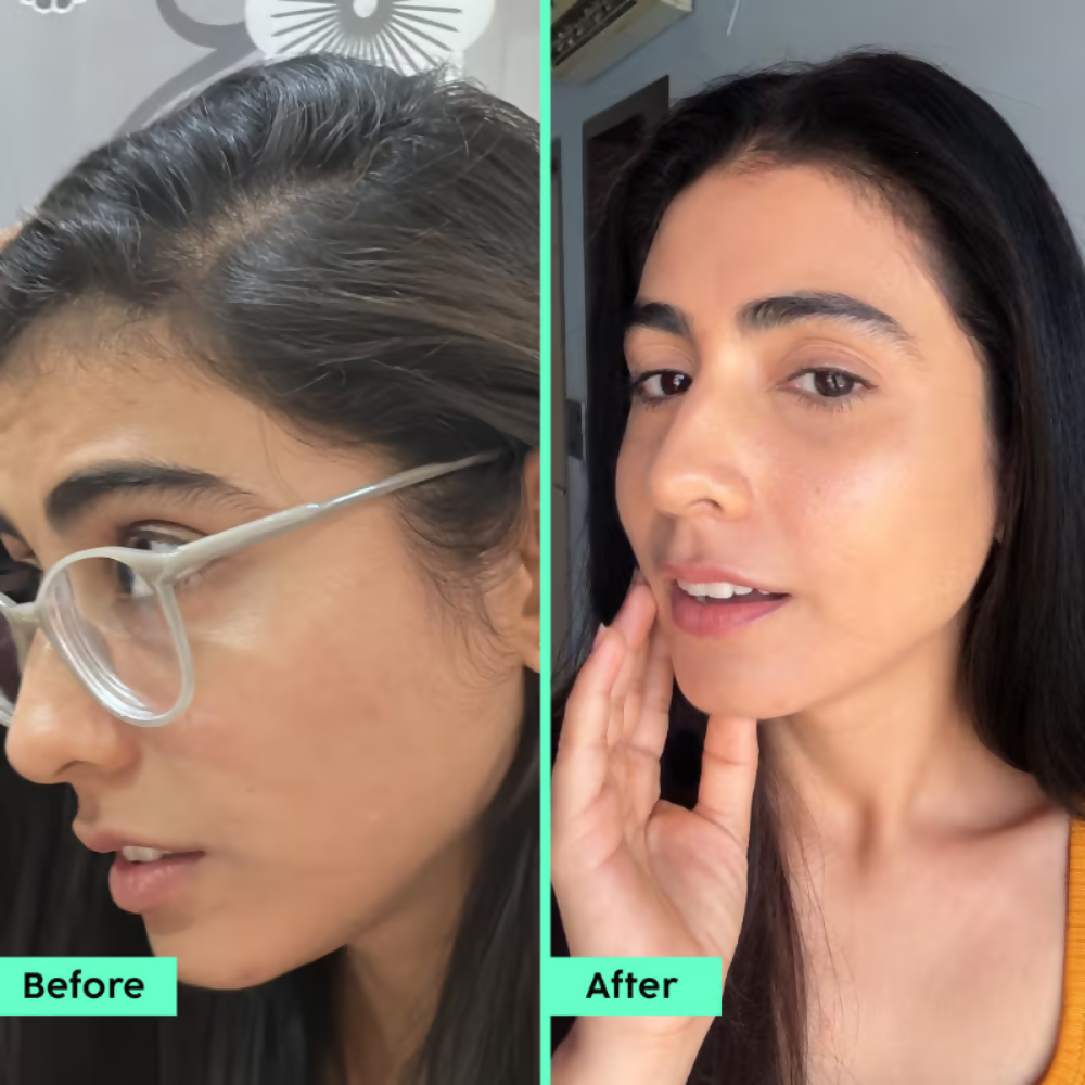 PLIX The Plant Fix Rosemary Advanced Hair Kit