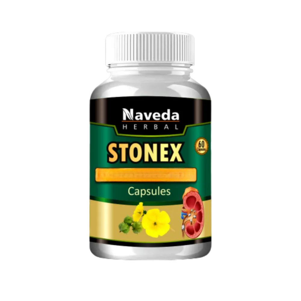 Naveda Herbal Stonex Capsules