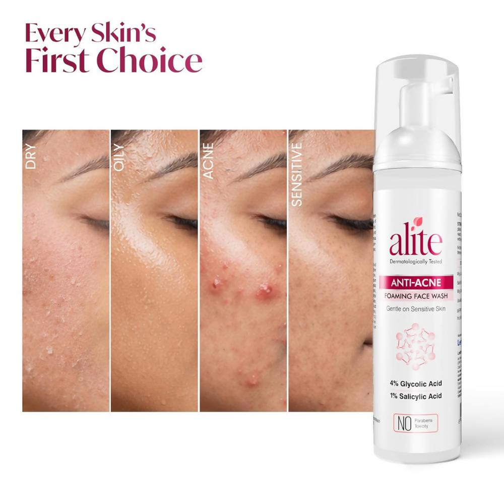Alite Anti Acne 5-in-1 Foaming Face Wash with 4% Glycolic Acid & 1% Salicylic Acid