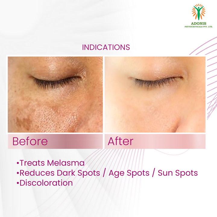 Adonis Ad Mela Tx Cream