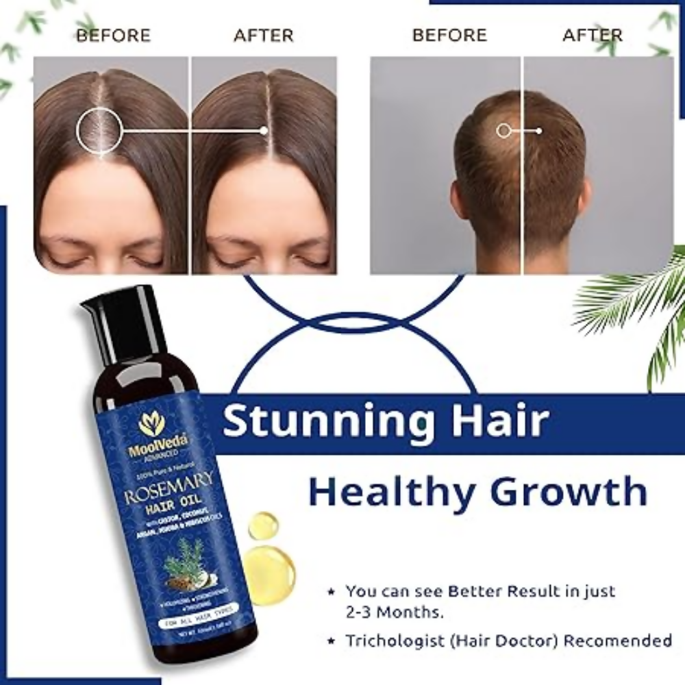 Moolveda 100% Pure Rosemary Hair Oil for Hair Growth