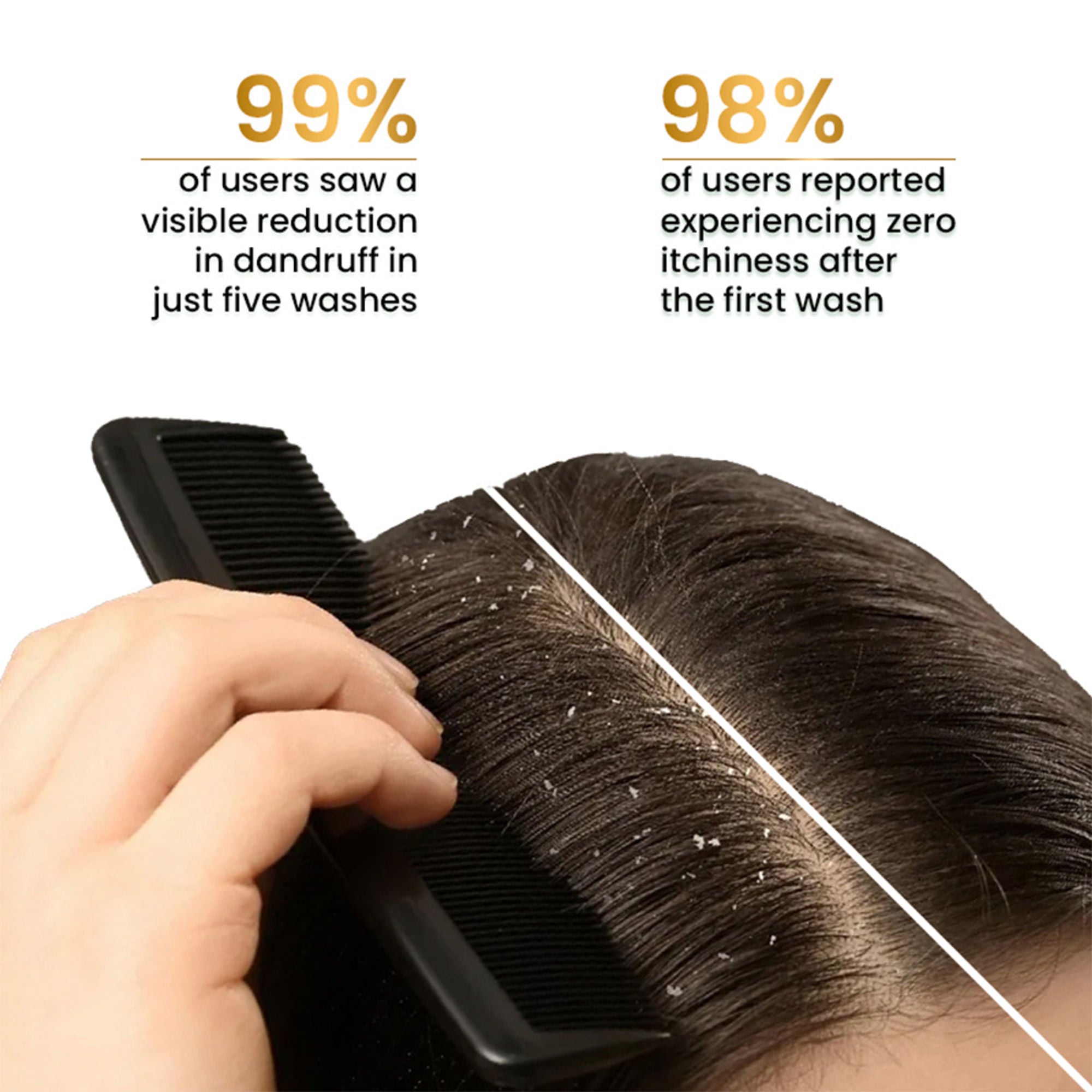 The Skin Story Anti Dandruff Deep Ceansing Shampoo Calms & Soothes Scalp With Saniscalp & Argan Oil