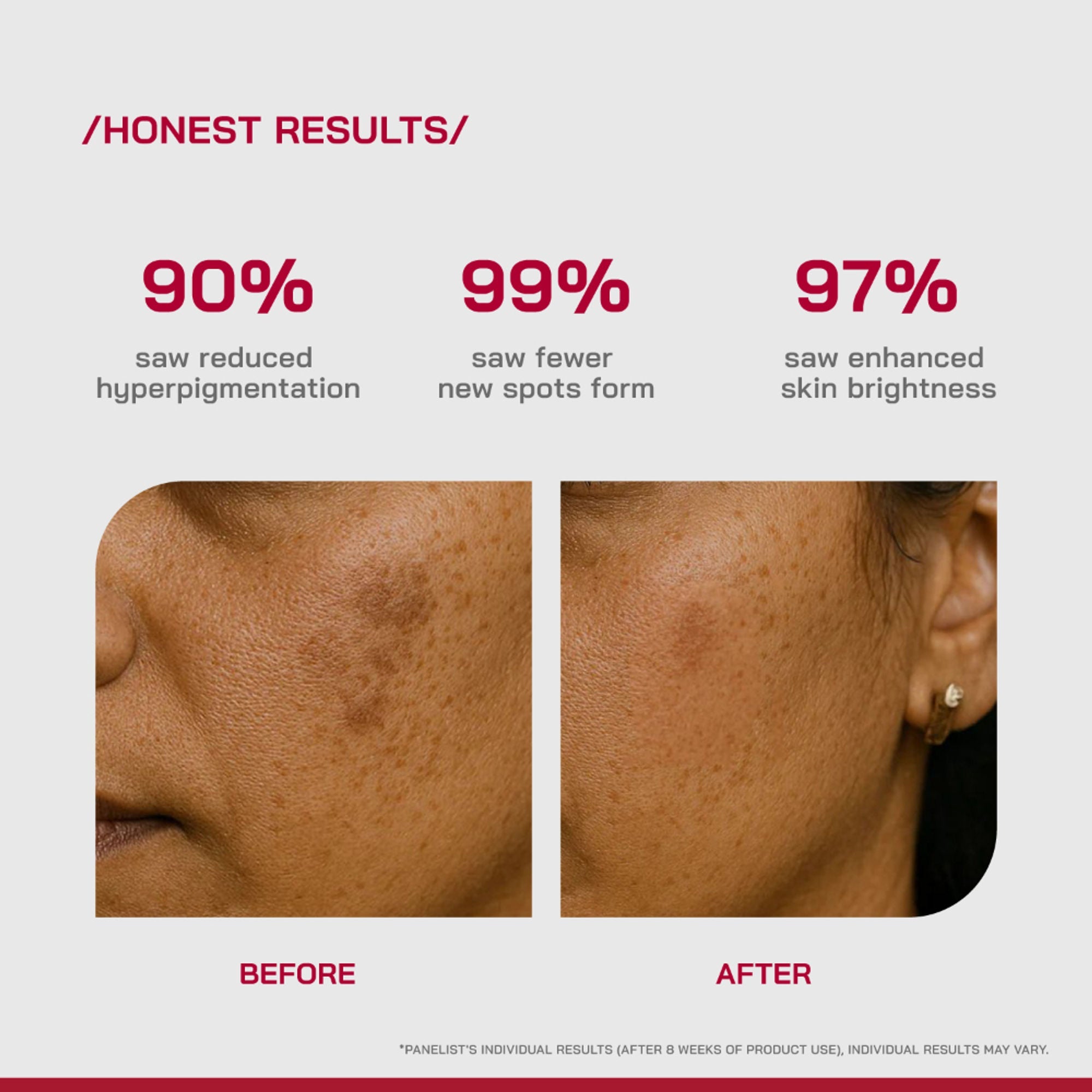 Proven Honest Derma (PHD) 2% Alpha Arbutin Serum