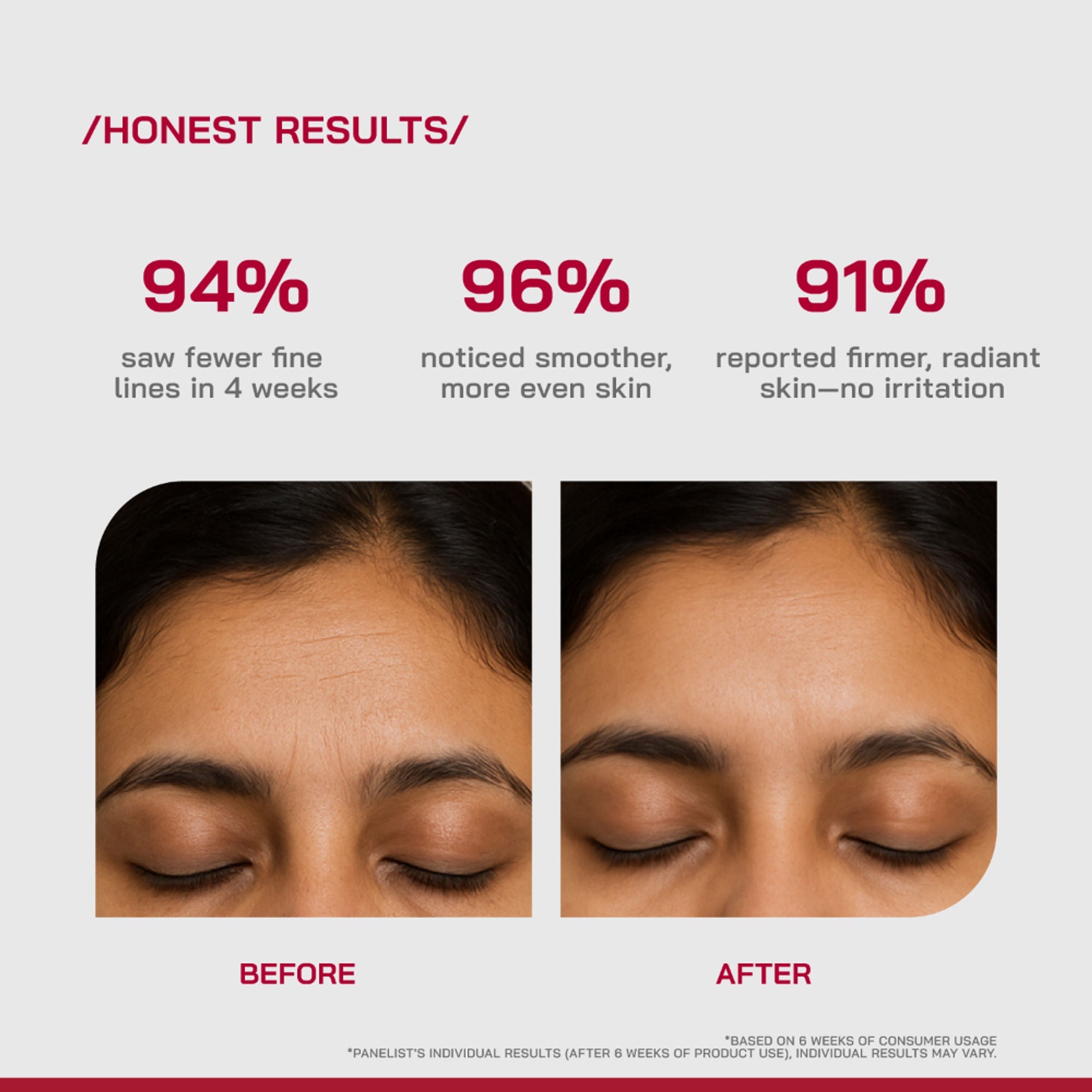 Proven Honest Derma (PHD) 0.3% Retinol Serum With Bakuchiol & Peptides
