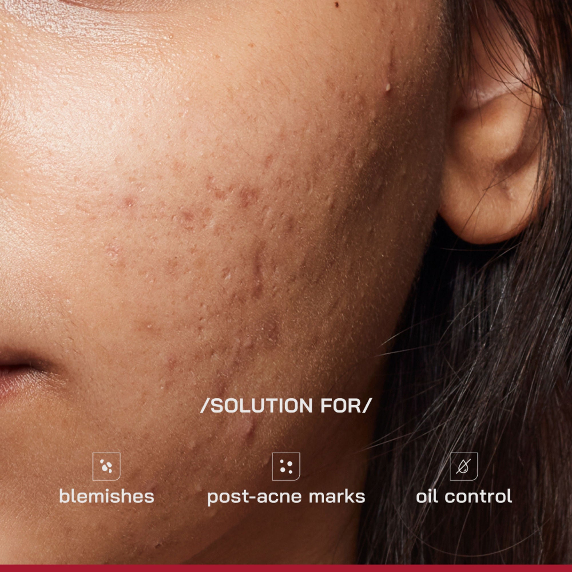 Proven Honest Derma (PHD) 10% Niacinamide Spot Correcting Serum