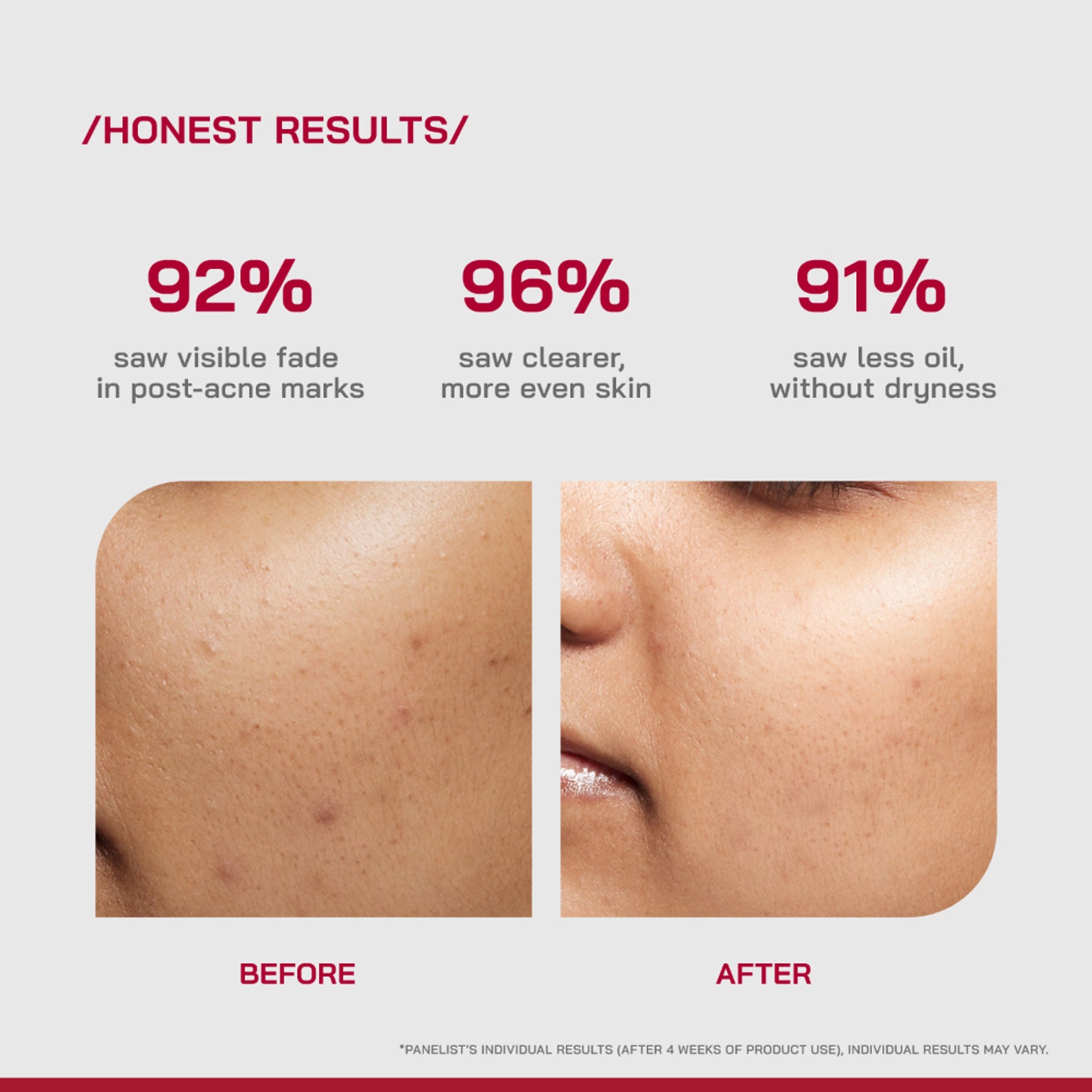 Proven Honest Derma (PHD) 10% Niacinamide Spot Correcting Serum