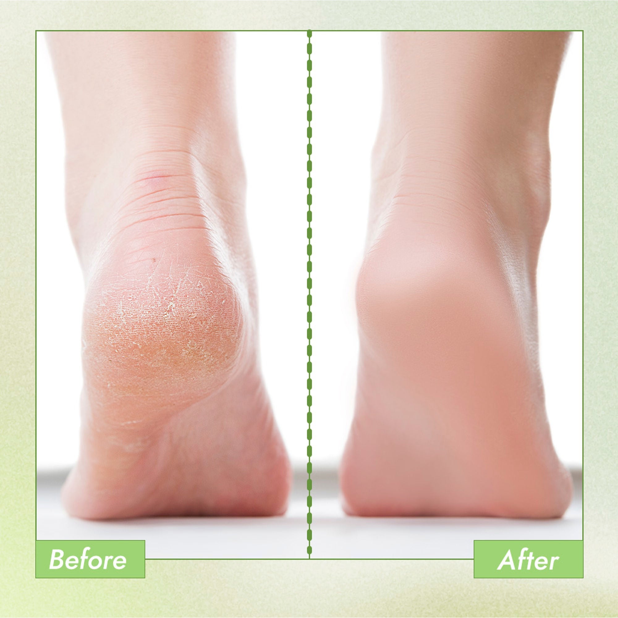 Nykaa Skin Happy Heels 20%Urea, 2%Lactic Acid Foot Cream-Dry & Cracked Feet - Tea Tree & Aloe Vera