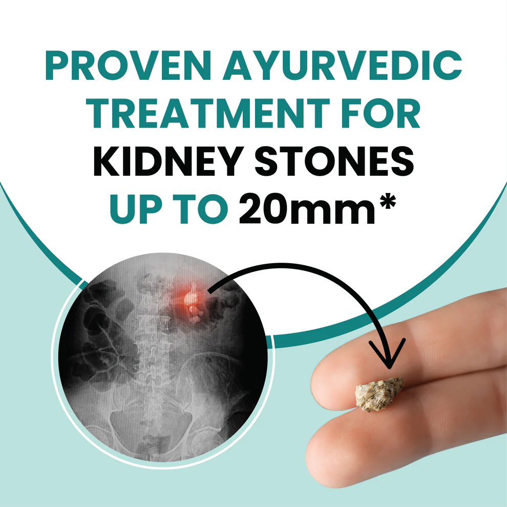 Dr Mantra Stone Crusher Capsules for Kidney & Urinary Tract Stones| 30 Capsules