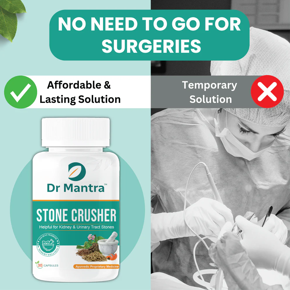 Dr Mantra Stone Crusher Capsules for Kidney & Urinary Tract Stones| 30 Capsules
