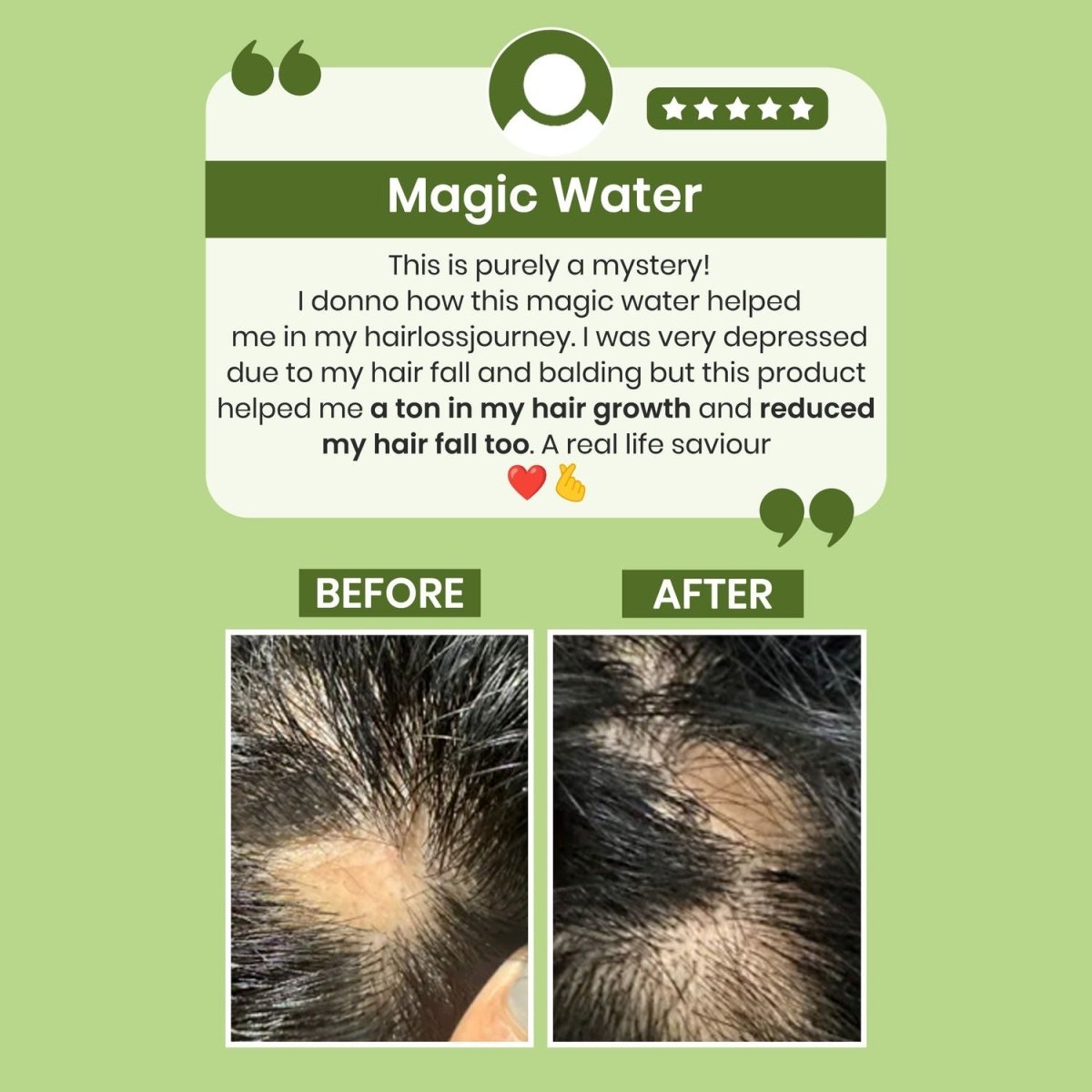 Alps Goodness Rosemary Water for Hair Regrowth