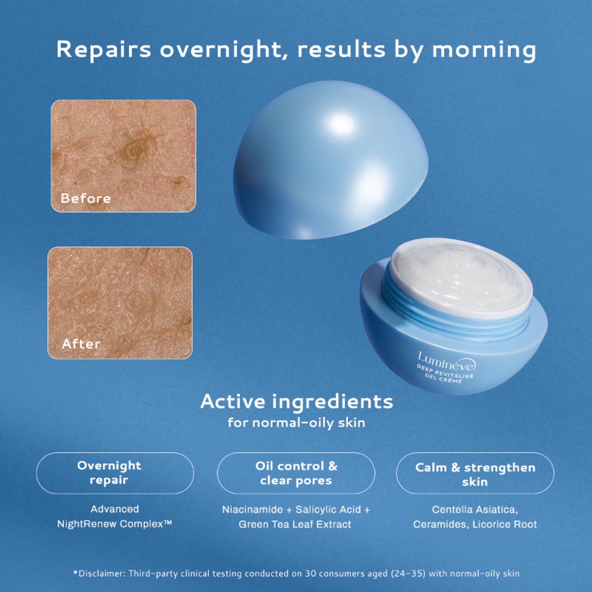 Lumineve Gel Moisturizer for Oily Skin with Salicylic Acid for Oil Control