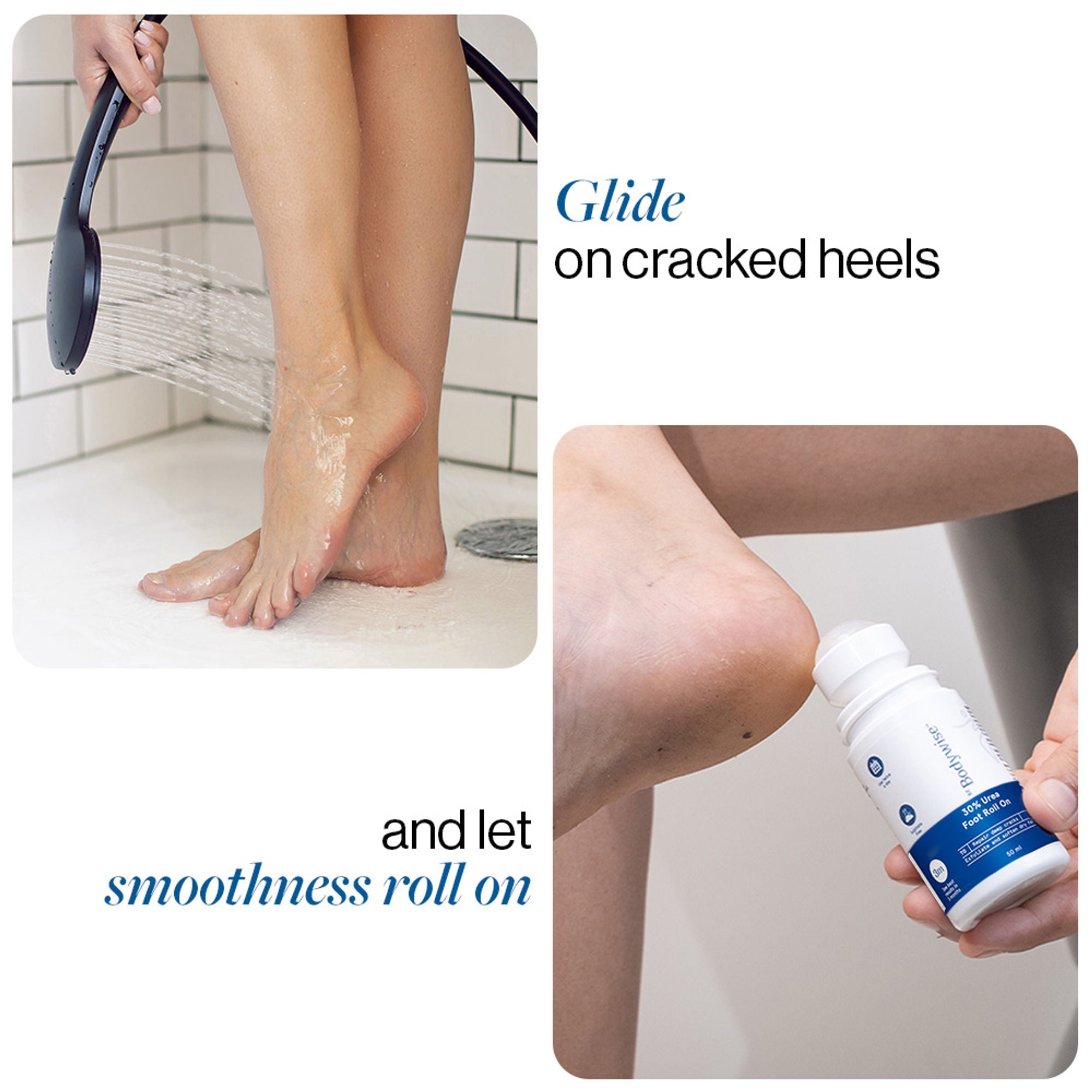 BeBodywise 30% Urea Foot & Heel Roll On For Very Dry Feet & Cracked Heels