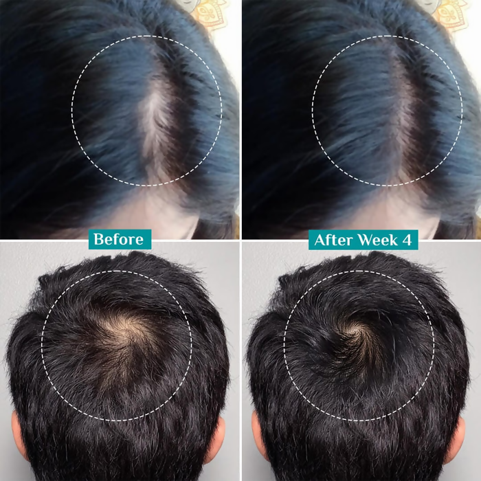 Pilgrim 3% Redensyl, 4% Anagain & 5% Capilia Stem Cell Complex Advanced Hair Growth Serum Roll-On
