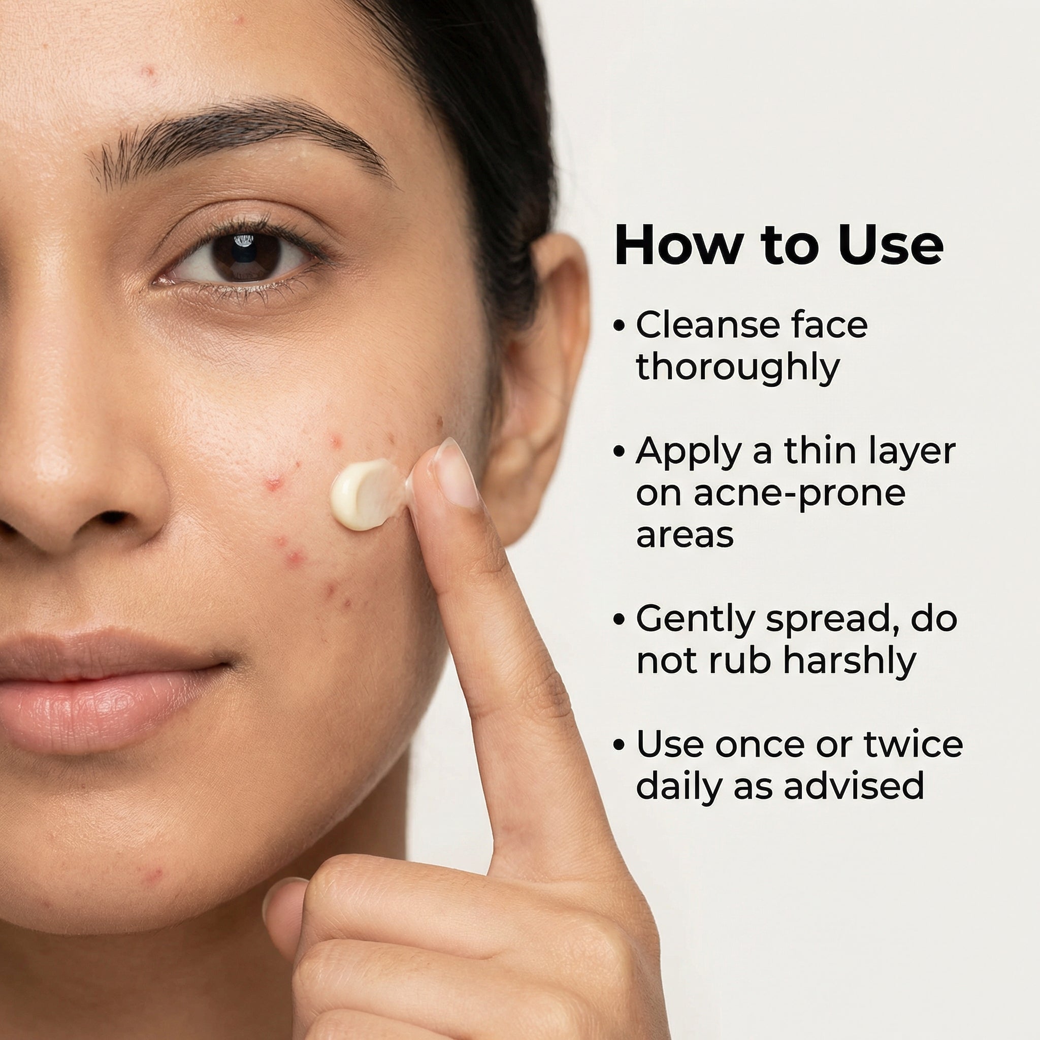 VedicDerm Nano Gold Acne Defence Cream with Turmeric and Nia-Cera-Peptide Complex™️
