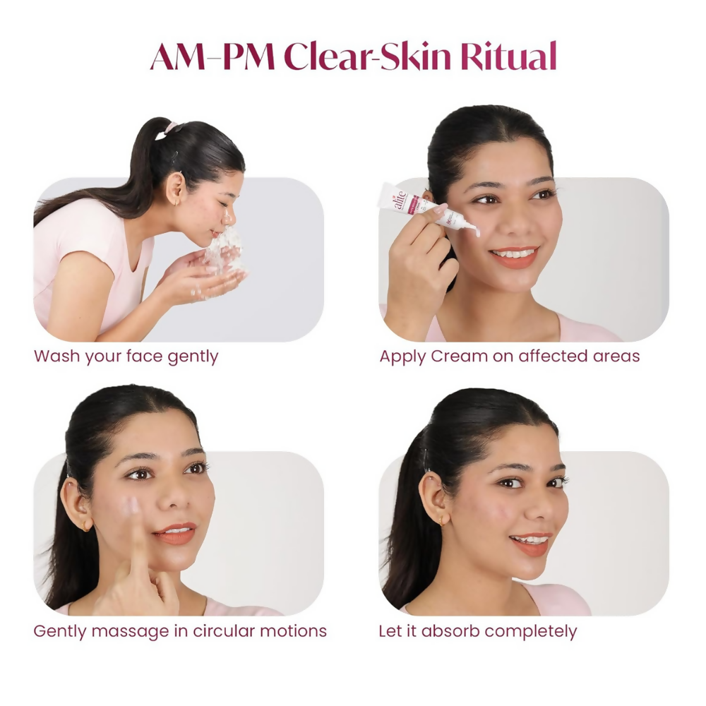 Alite Spots Reduction Cream with 5X Enhanced Absorption