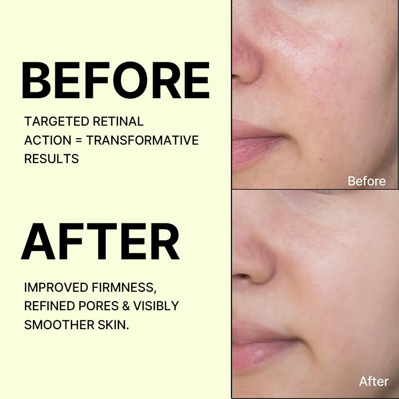 Celimax The Vita-A Retinal Shot Tightening Booster For Anti-Aging, Dark Spots & Wrinkles