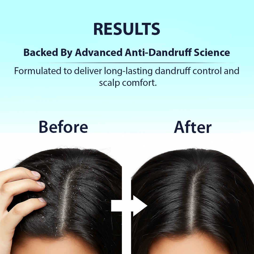 Dermistry Anti-Dandruff Control Shampoo Mask & Serum