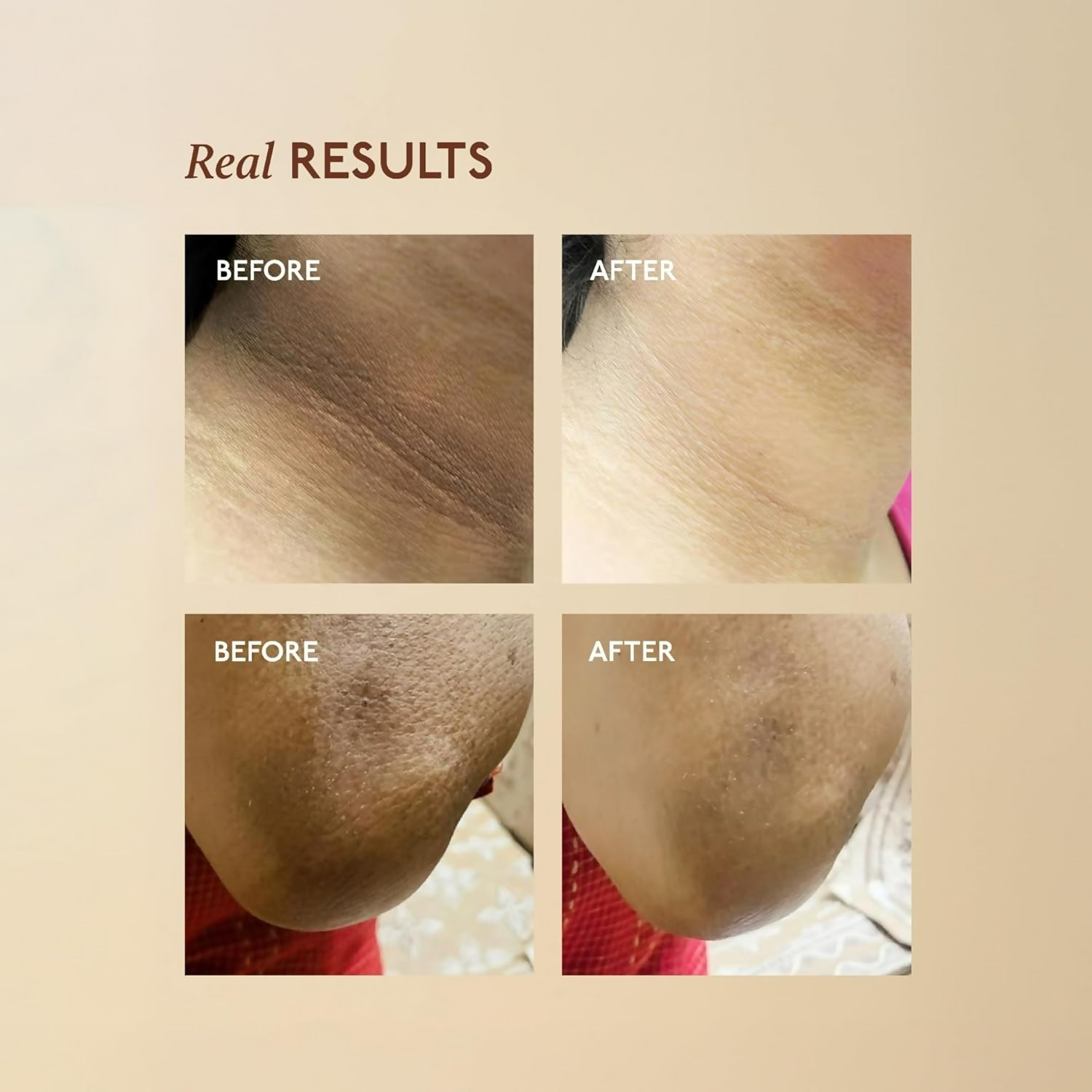 Asaya Tone Restore Advanced Pigmentation Cream with MelaMe Complex