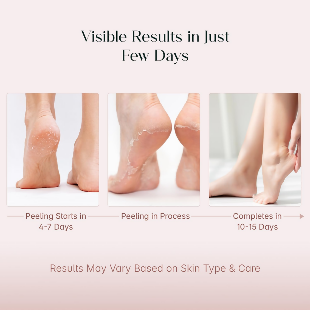 Seoulskin Glycolic Acid Foot Peeling Mask
