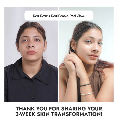 COSIQ Vitamin CEF-20% Face Serum